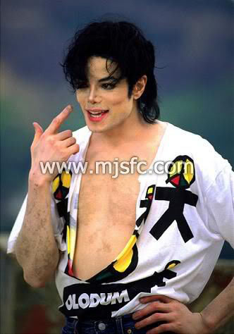 http://popshifter.com/wp-content/uploads/2009/07/vitiligo-mjsfccom-photo.jpg